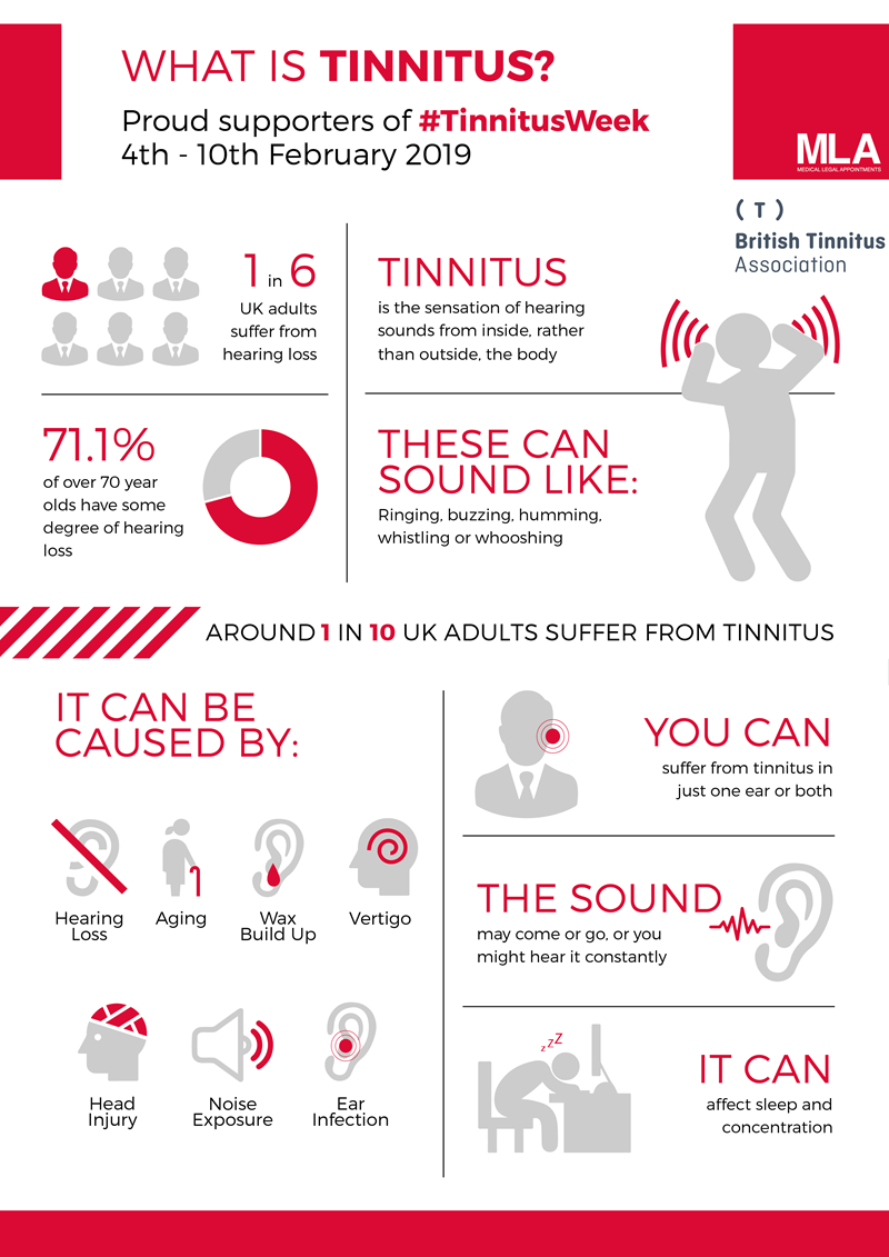 What is Tinnitus?